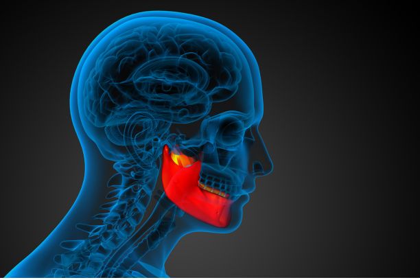 Jaw Fracture